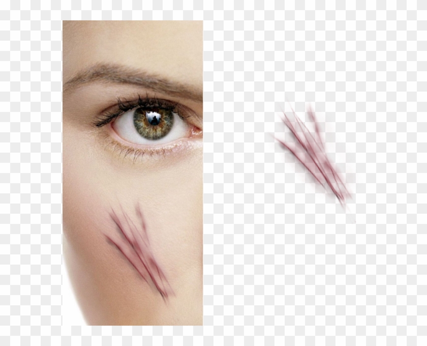 Create Scratches - Stitches On Face Png Clipart