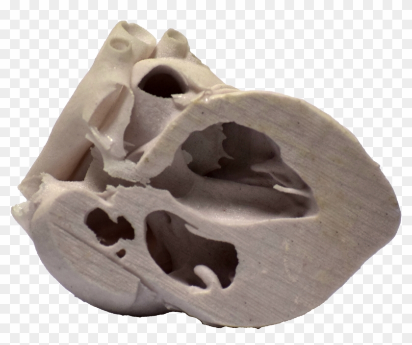 3d Printed Heart Cross Section - Skull Clipart #4805884