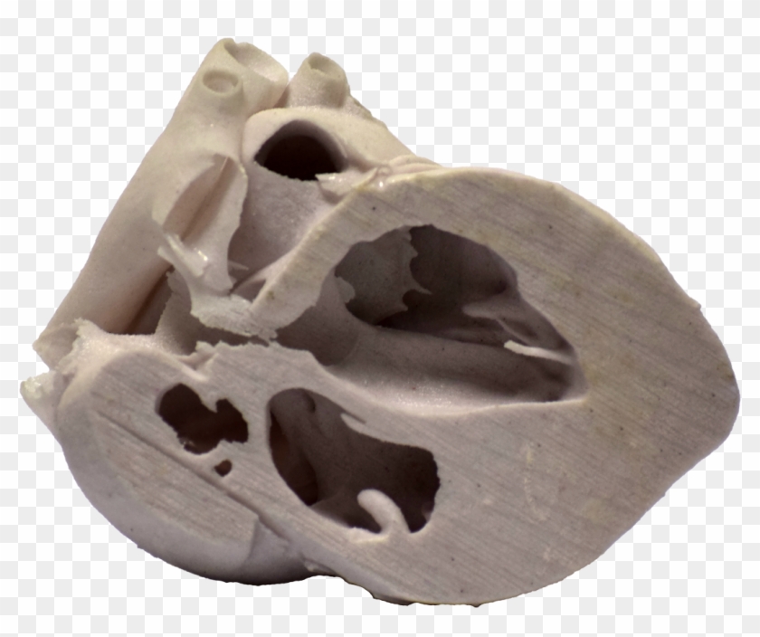 3d Printed Heart Cross Section - Skull Clipart