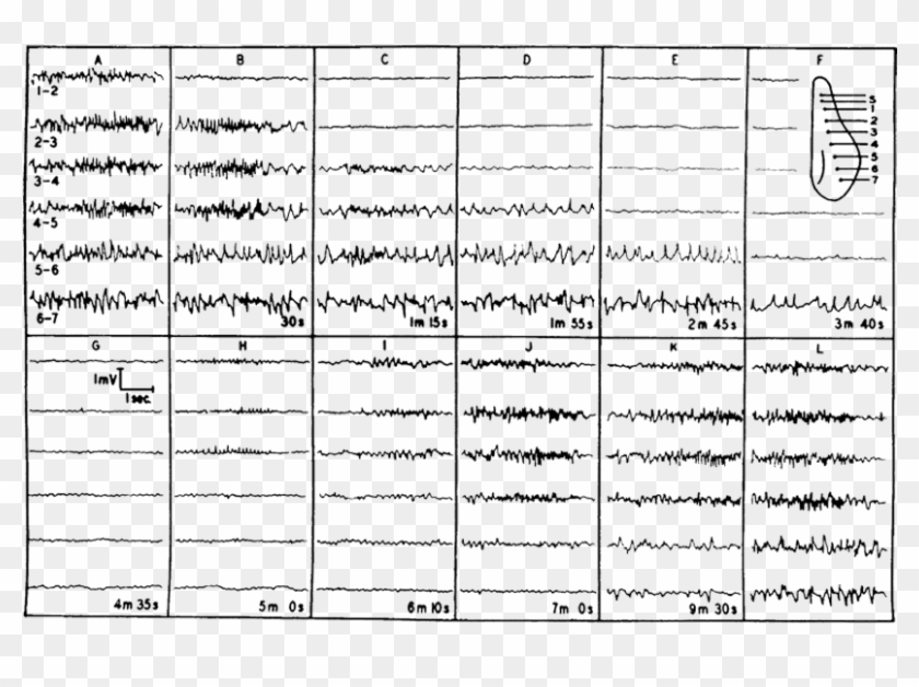 U Bolt Dimension Clipart