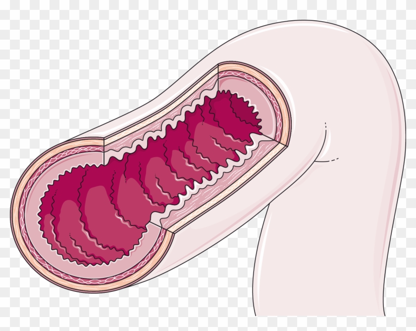 Download The Image - Oxalobacter Formigenes Clipart