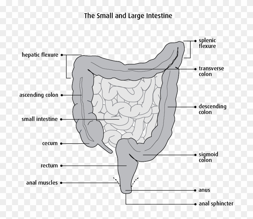 Bowel Resection Clipart #4858700