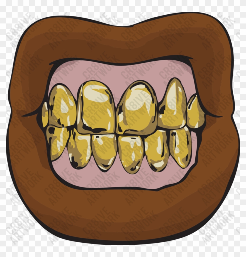 Vector Free Download Lips N Logo By Cr Iveartwork On - Mouth With Grill Png Clipart