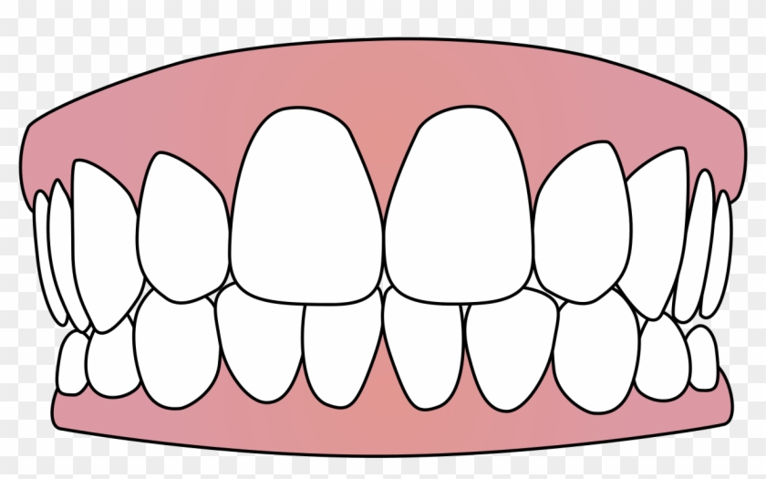 Free Vector Download - Transparent Background Teeth Clipart - Png Download
