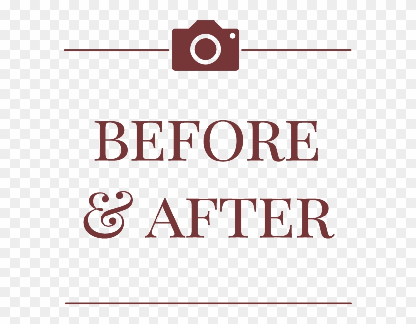 Before Png - Before After Photo Png Clipart #5002488