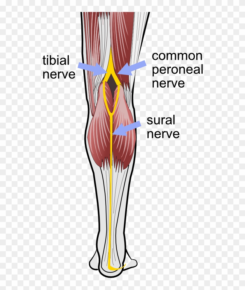 Sural Nerve, Common Peroneal Nerve, Tibial Nerve - Sural Nerve Tibial Nerve Clipart #5003224