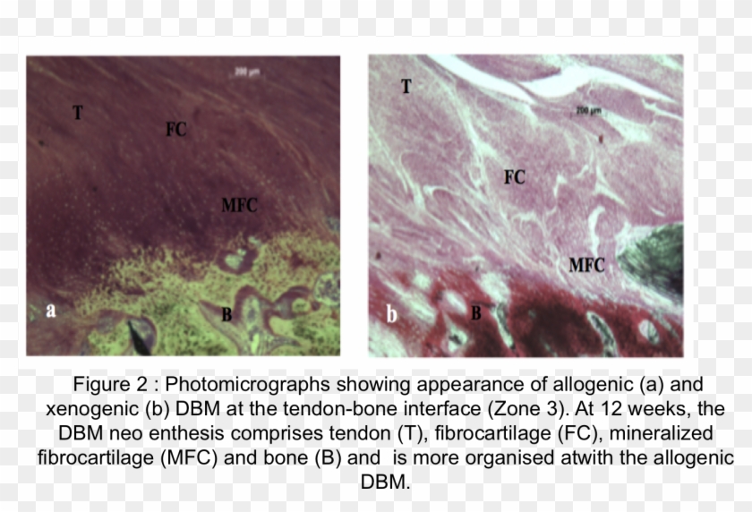 Tendon Bone Healing Can Be Enhanced By Demineralized - Freshwater Whipray Clipart