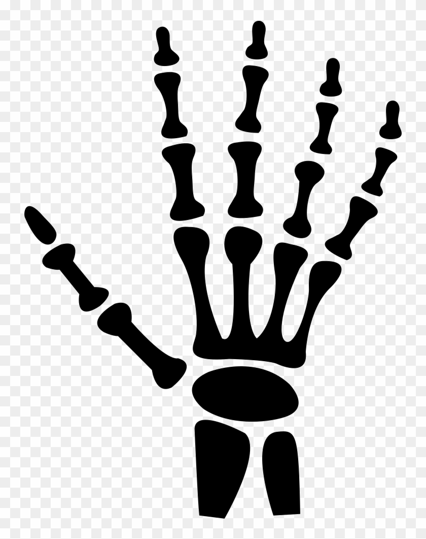 Human Hand Bones Comments - Skeleton Hand Silhouette Clipart