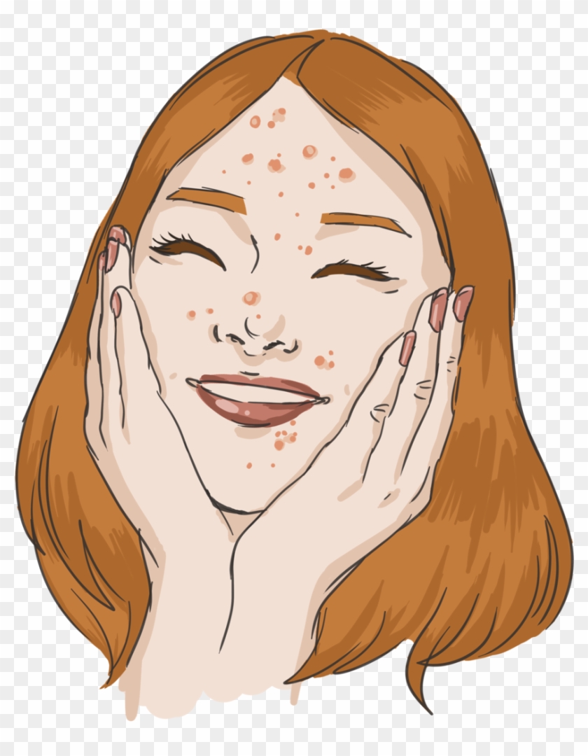 Pimple Png - Cute Acne Clipart