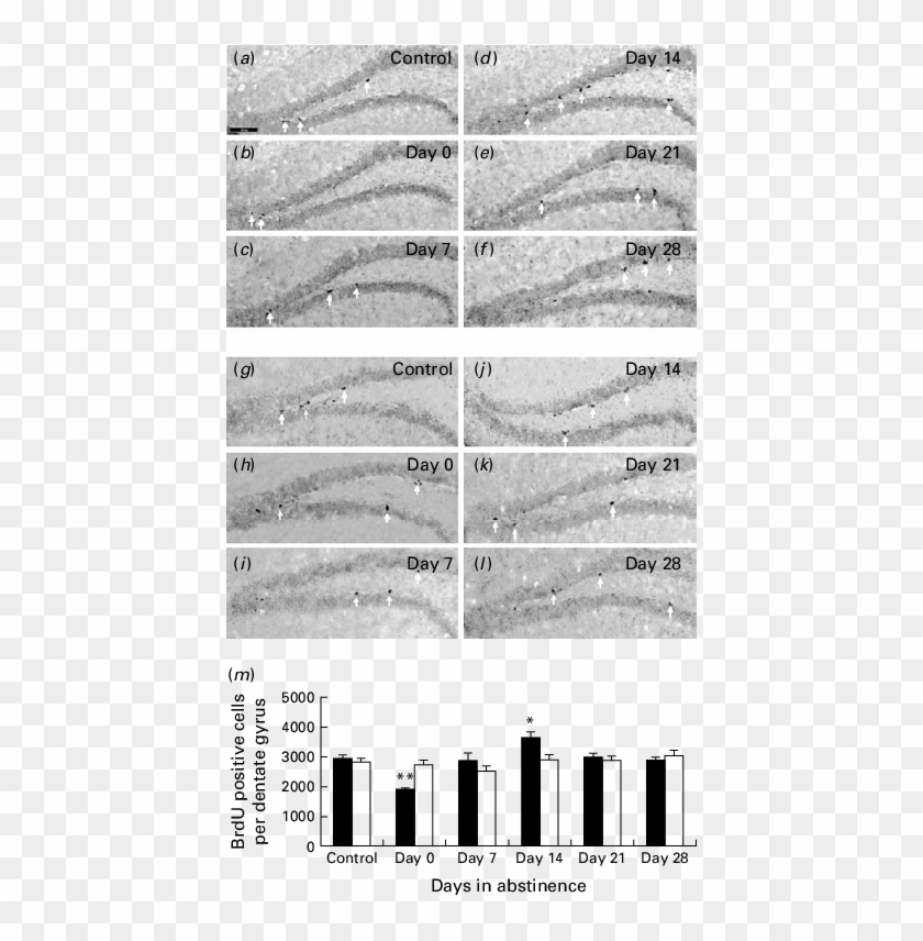 Effects Of Aqp4 Knockout On Cell Proliferation In Mouse - Colorfulness Clipart #5072003
