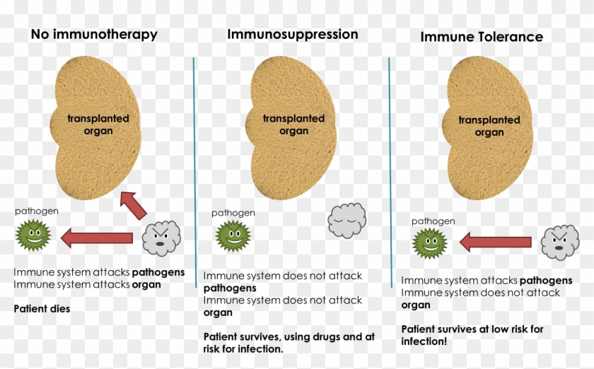 Immune Tolerance Def - Tree Clipart #5108709