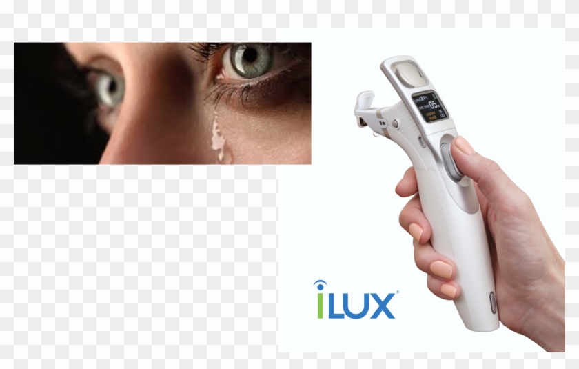 Tearfilm Innovations Ilux® Dry Eye Treatment System - Trigger Clipart