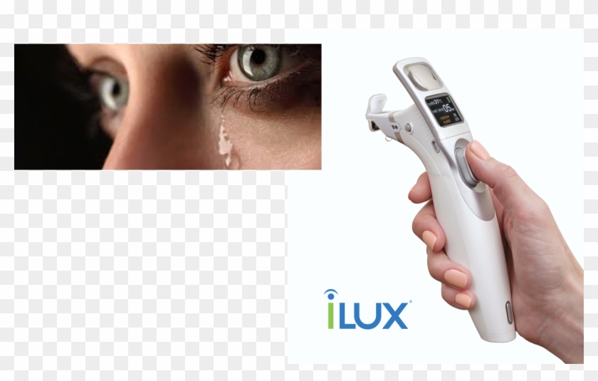 Tearfilm Innovations Ilux® Dry Eye Treatment System - Trigger Clipart #5109146