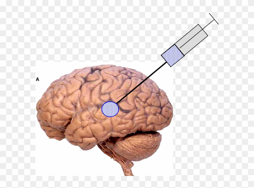 Brain2 - Nbme 15 Brain Clipart #5110086