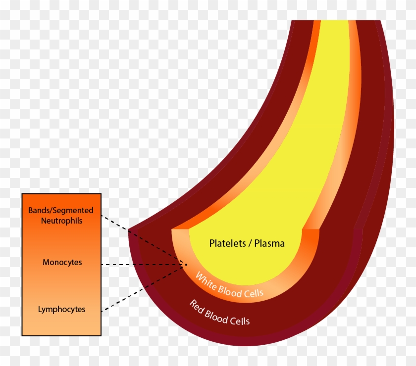 Blood Drawn From A Donor Is Separated Via The Apheresis - Graphic Design Clipart #5136710