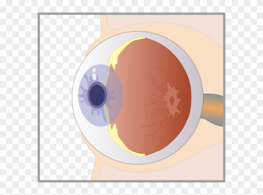 Small - Eye Diagram No Background Clipart #5141445