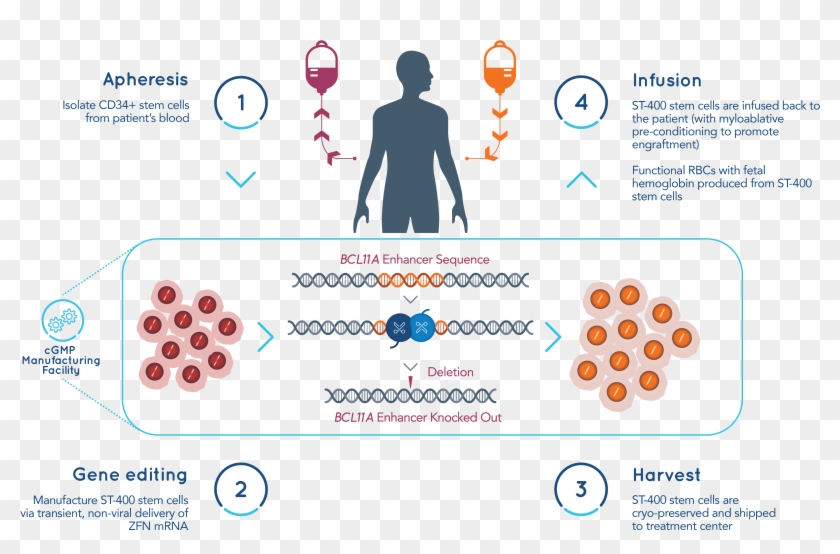 Autologous Vs Allogeneic Cell Therapy Clipart