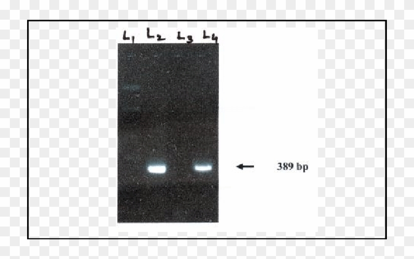Nested Pcr Of 16s Rrna Of E - Granite Clipart