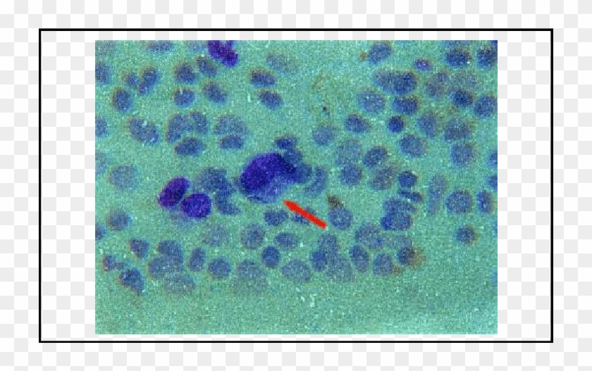 Inside Erythrocyte Fig - Visual Arts Clipart #5158742