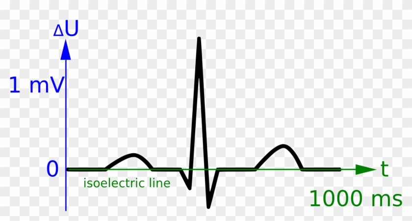Picture Free Library File Curve Scales Wikimedia Commons - Ecg Curve Clipart