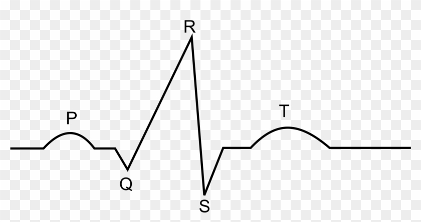 Svg Freeuse File Diagram Wikimedia Commons Open - الکترو کاردیو گرام Clipart #5166347