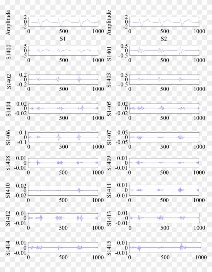 Results Of Ecg Signal Decomposition Using Wpd - Electric Blue Clipart
