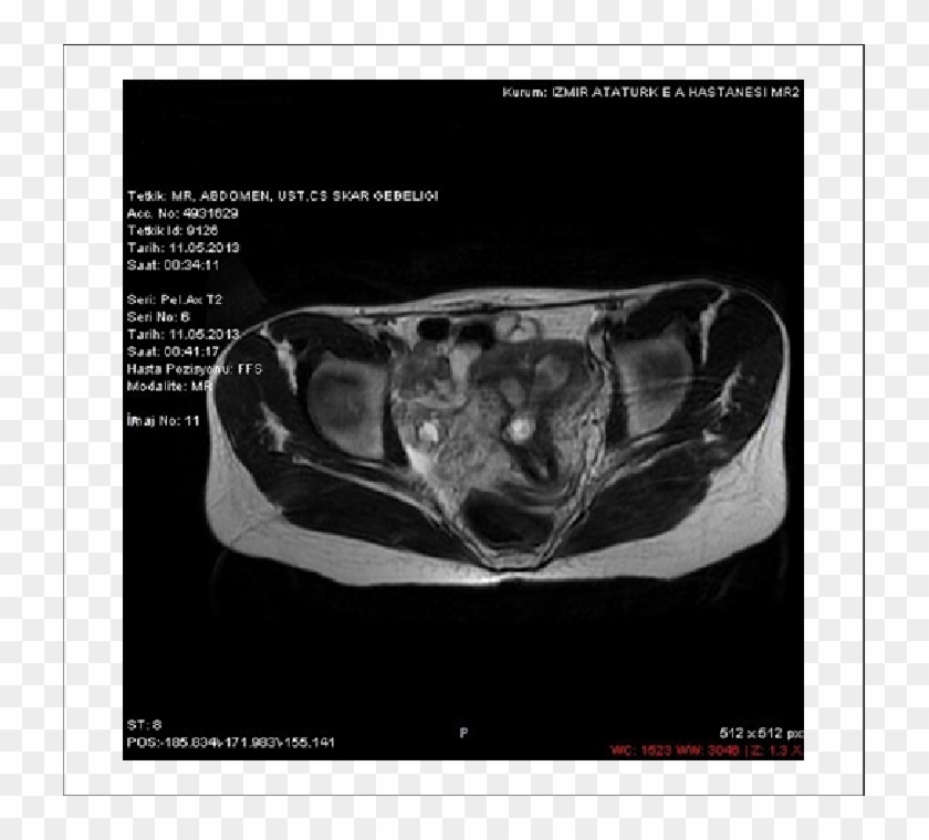 Magnetic Resonance Imaging Examination Of Case - Computed Tomography Clipart