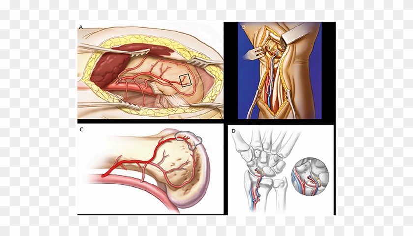 J Bone & Joint Surg - Illustration Clipart #5224347