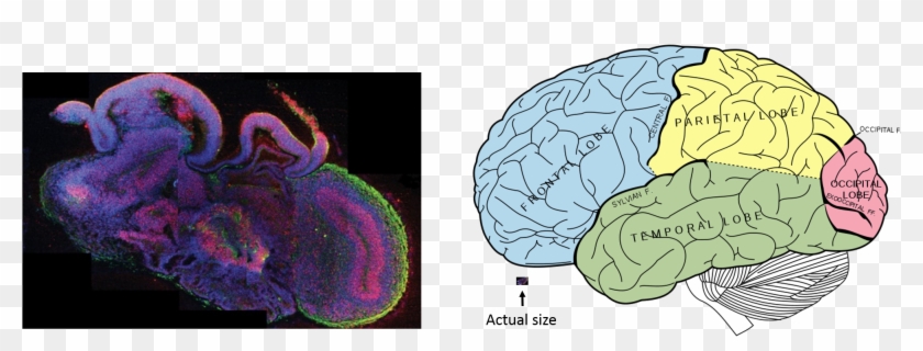 A Human In Petri Transparent Background - Human Brain Organoids Clipart #5268030
