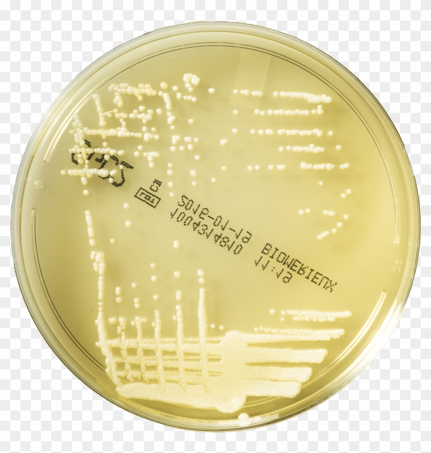 Conventional Media For Fungal Infections - Staphylococcus Aureus On Sab Agar Clipart #5268182