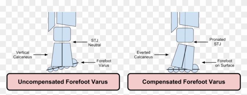 The Gait Guys Clipart