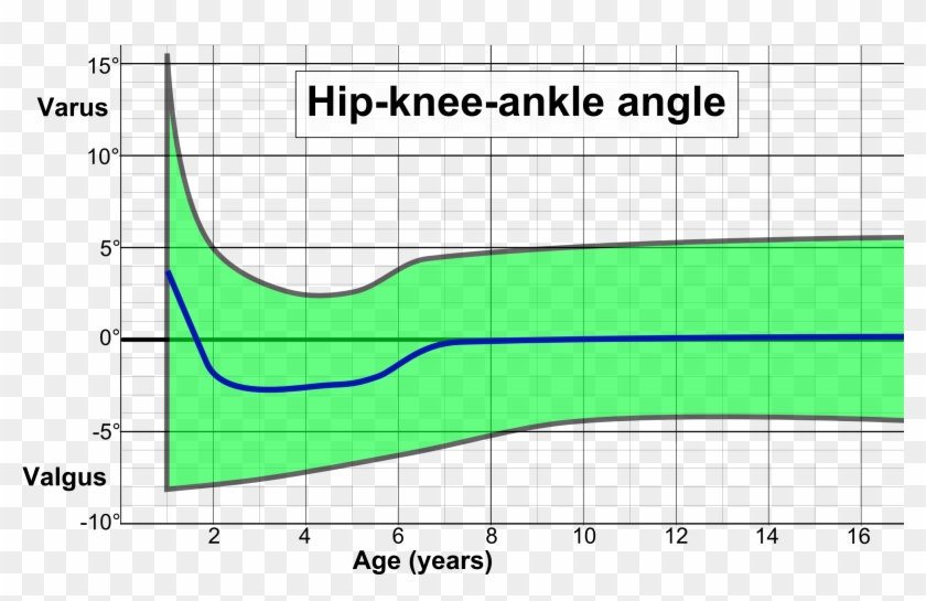 Hip Knee Ankle Angle By Age - Plot Clipart