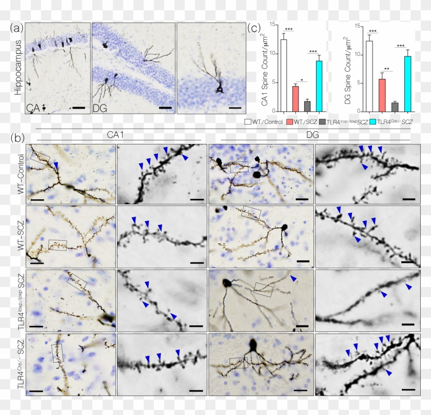 Neural Camkiiα Expression In A Mouse Model Of Nmdar - Graphics Clipart #5297806