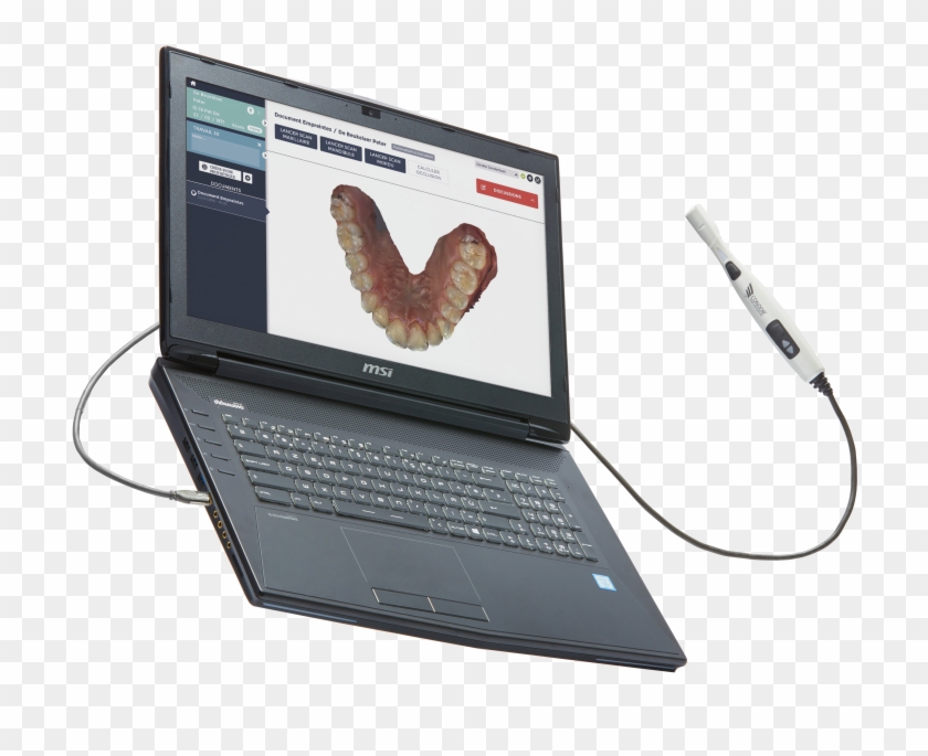 Hyper Realistic Colors - Oral Scanner Clipart #5300881