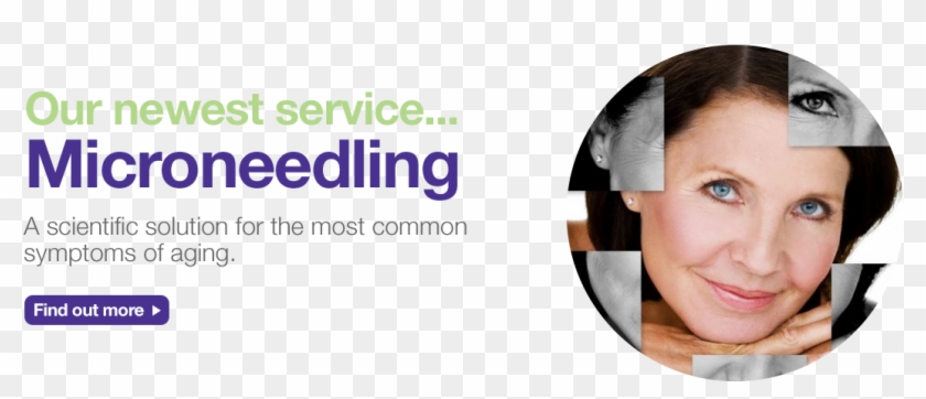 A Scientific Solution For The Most Common Symptoms - Dermaspark Dermaroller Clipart #5314355