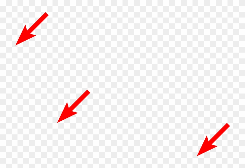 Ribosomes On Rer - Illustration Clipart #5357517