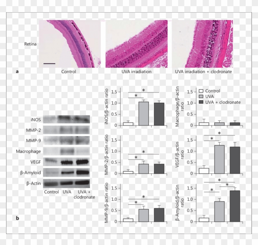 Long-term Ultraviolet A Eye Irradiation Induced Retinal - Architecture Clipart