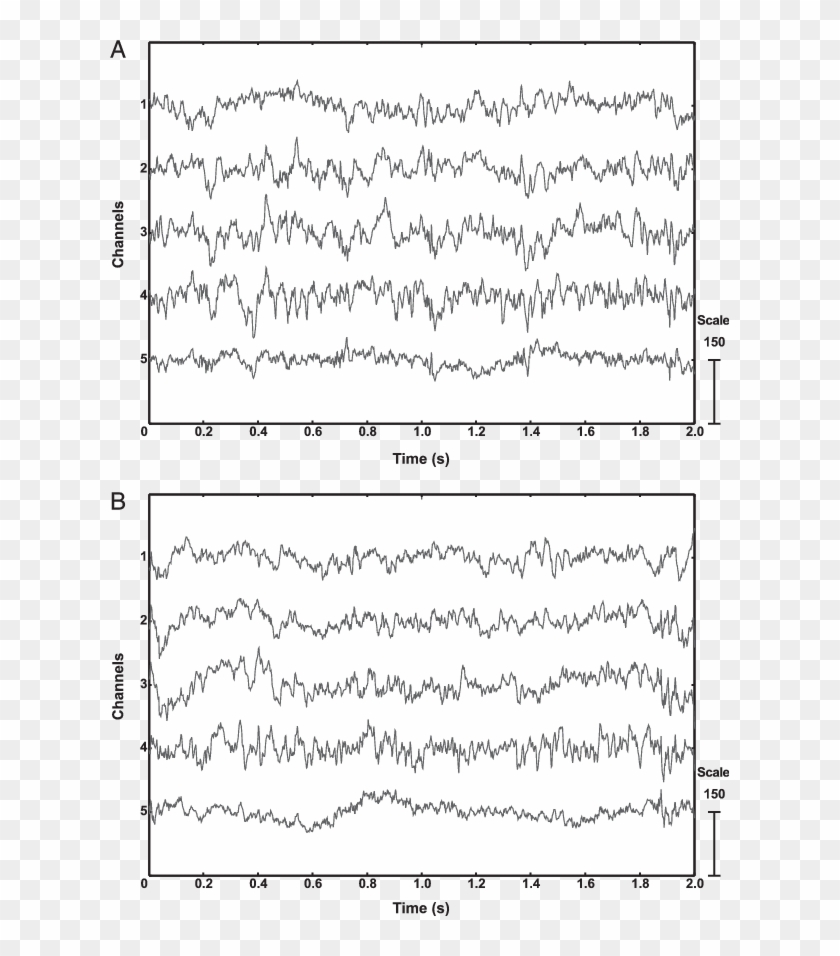 Eeg Record From The Flying And Resting Pigeon (b) That - Handwriting Clipart #5395618