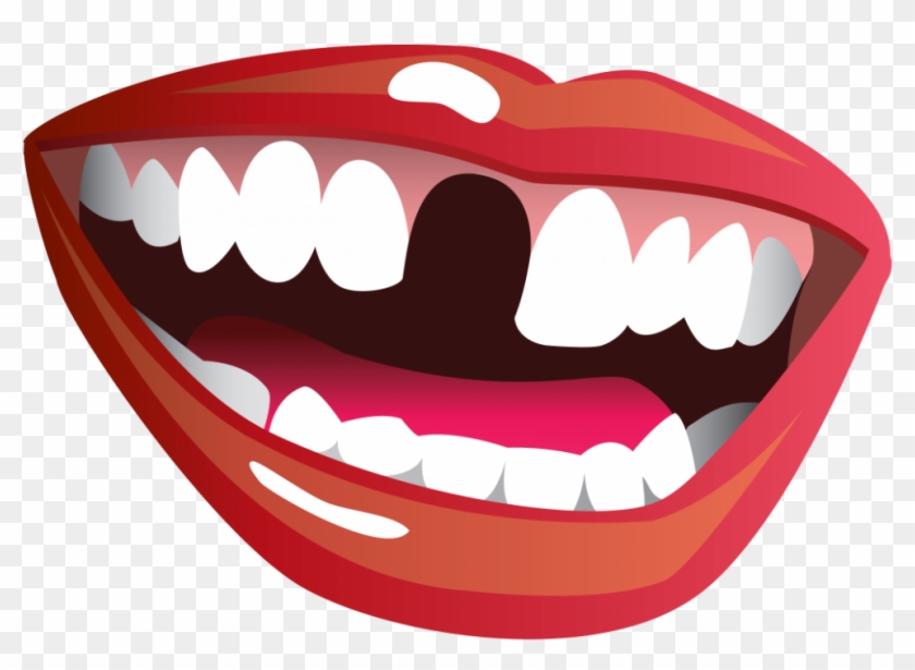 Smile With Missing Tooth Clipart