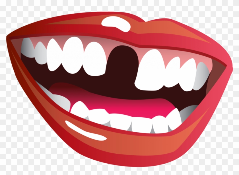 Smile With Missing Tooth Clipart #547323