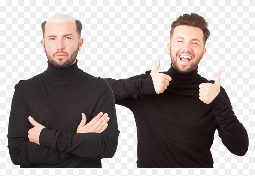 Discover The Most Natural, Modern And Stylish Non-surgical - Non Surgical Hair Replacement Uk Clipart