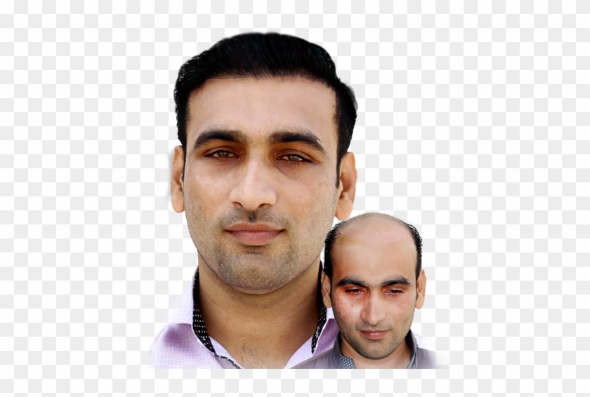 Hair Wigs Are Usually Used For Style Standpoint Or - Gentleman Clipart #5403881