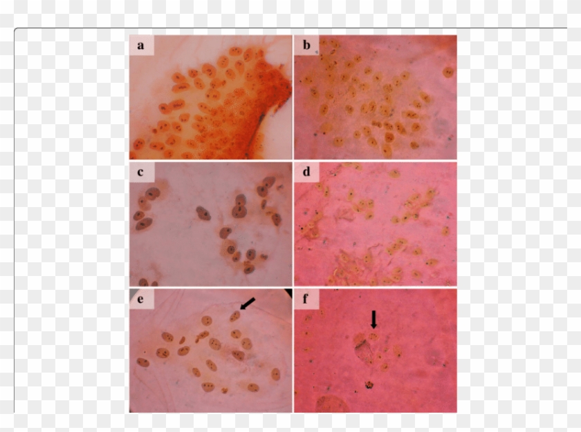 Interphase Nuclei From Rainbow Trout Stained With Silver - Tile Clipart