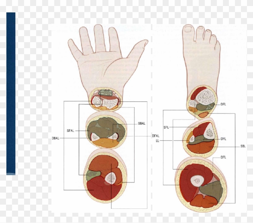 The Arm Lines - Cartoon Clipart #5468530