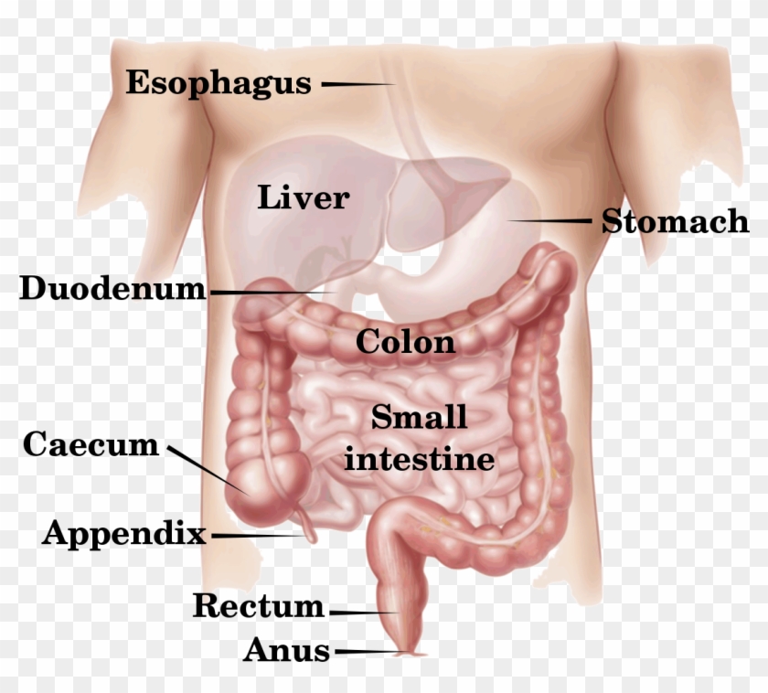 Digestive Tract - Colon Cancer Clipart