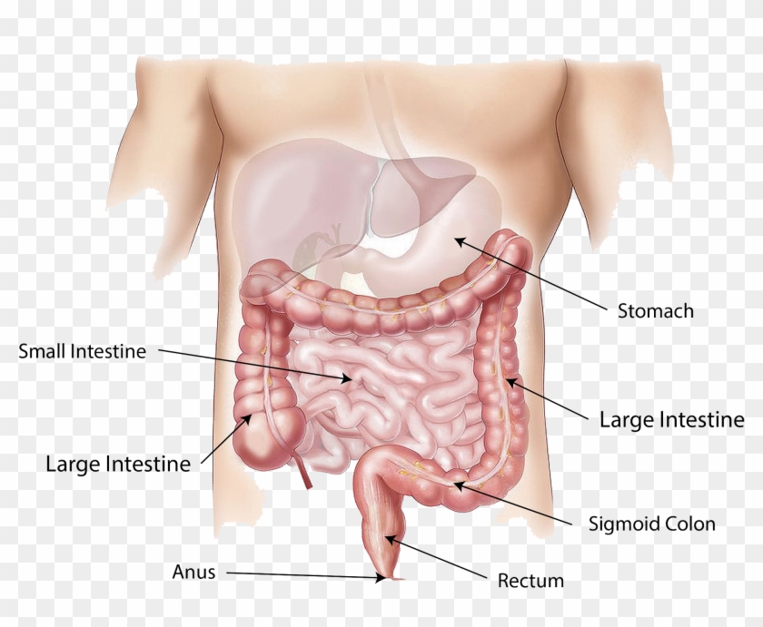 Abdomen - Colon Cancer Clipart