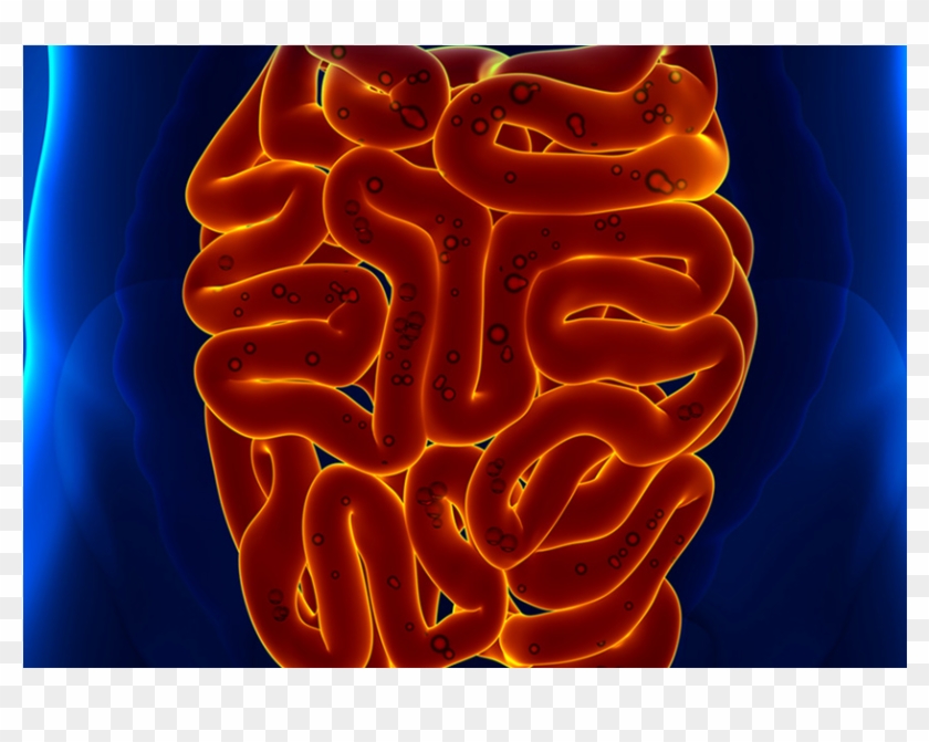 The Health Of Your Gut More Important Than You Think - Feci Colore E Forma Clipart #5469349