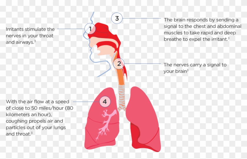 How Do We Cough - Legionnaires Transmission Clipart