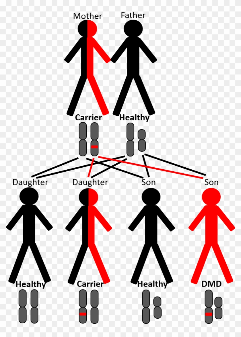 Therefore, The Vast Majority Of Patients With Dmd Are Clipart #5572163