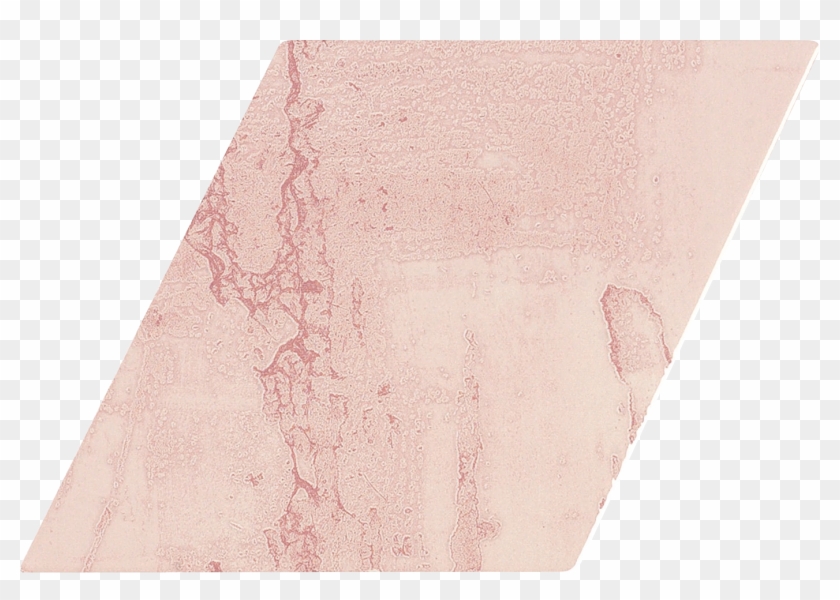 A034383 Snap Rombo Pink - Art Clipart #5583189